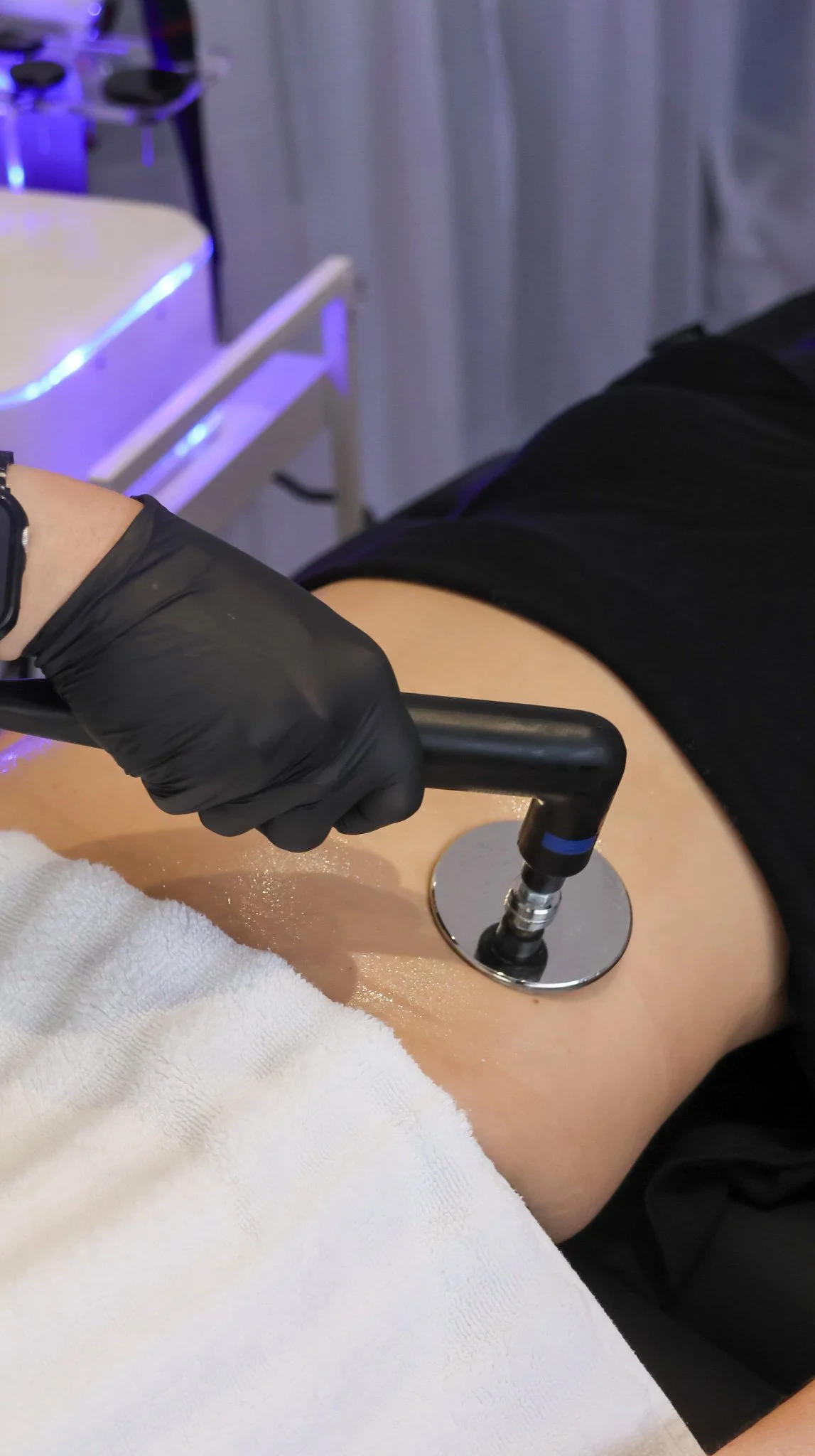 A person wearing black gloves is holding a laser device, performing a cosmetic or medical treatment on someone's back. The person is in a clinical setting with white and purple lighting.