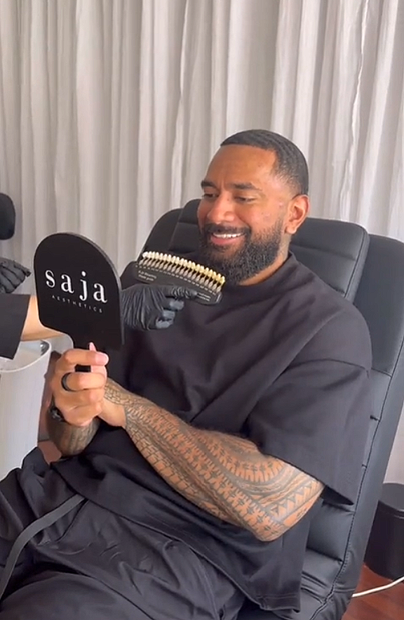A man with a tattooed arm sitting in a chair, smiling while holding a mirror.  A hand with a glove is near his face, holding a dental shade guide close to his teeth preparing for a teeth whitening treatment.