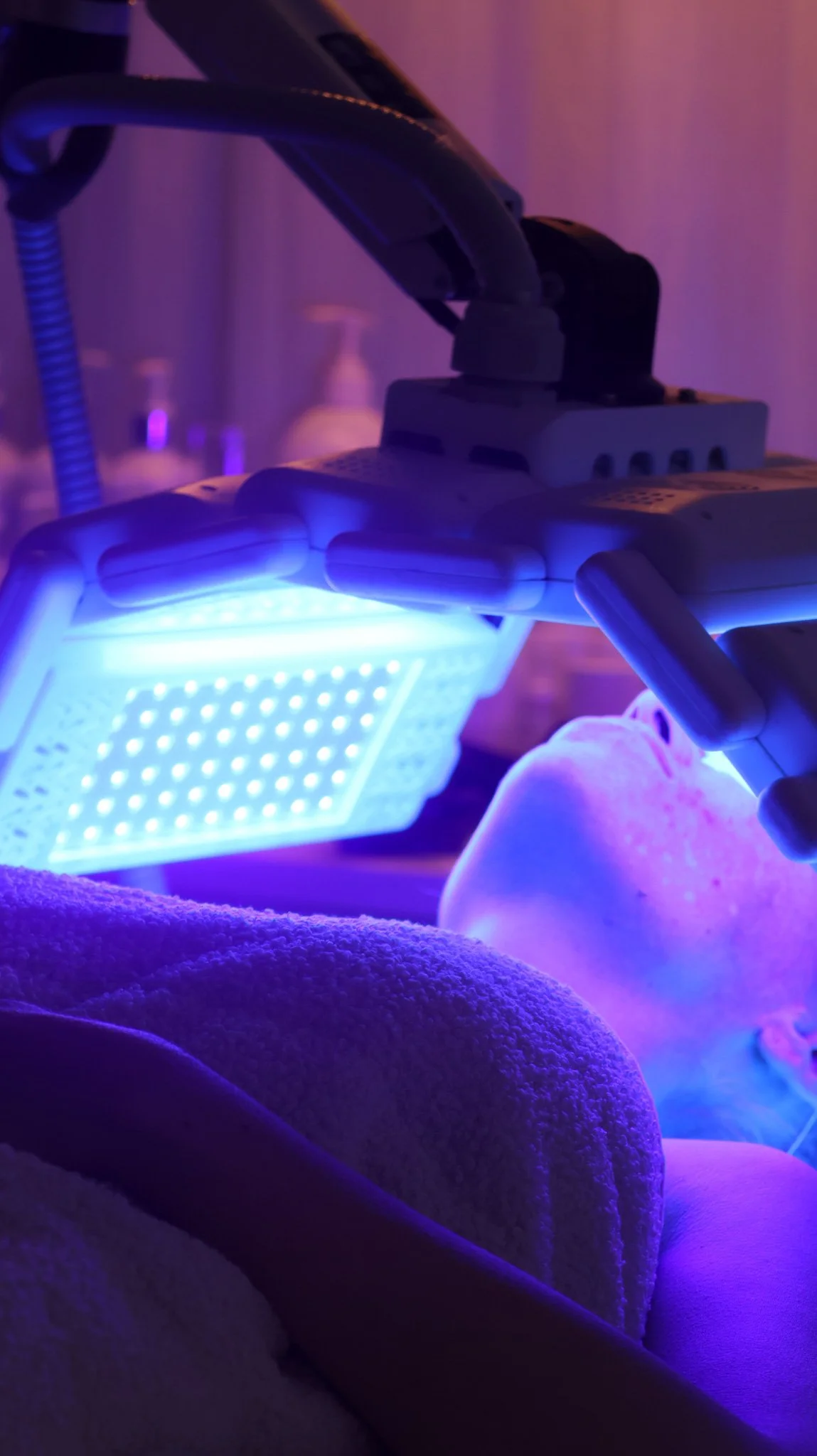 Close-up of a medical laser device emitting blue light, with a patient's foot covered by a towel in the foreground, in a dimly lit room with purple lighting.