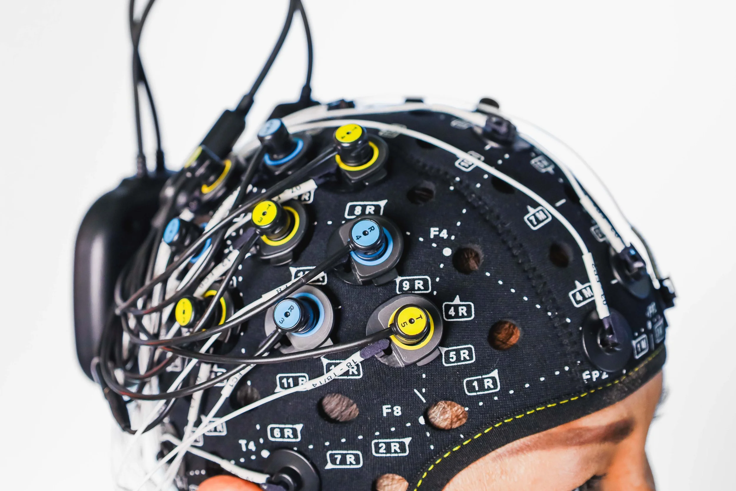 [fNIRS-EEG] multimodal-7.jpg