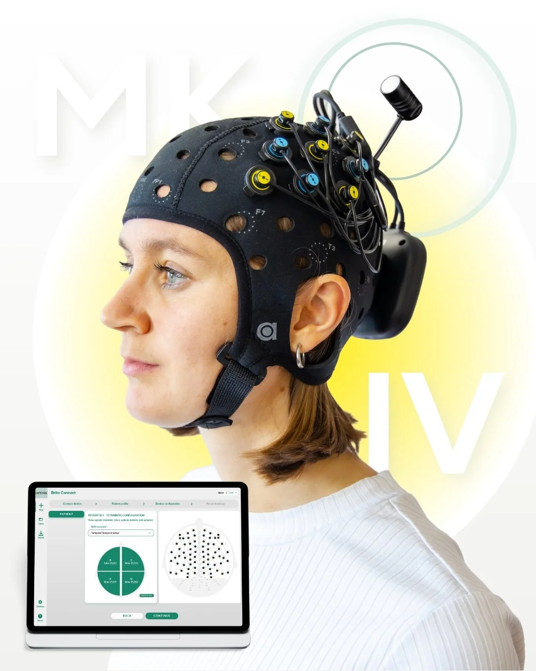 Brite News: Significantly decrease your setup time with our new Brite