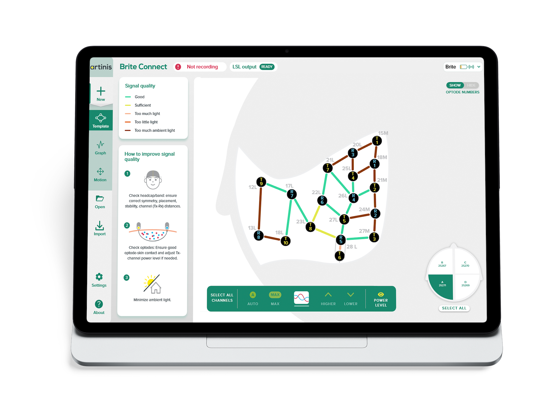 [Brite Connect] TetraBrite template overview.png