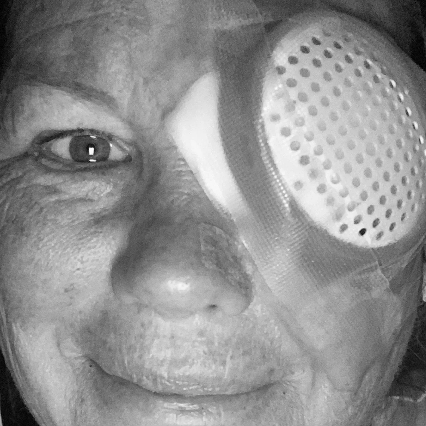 Losing Sight, Finding Direction