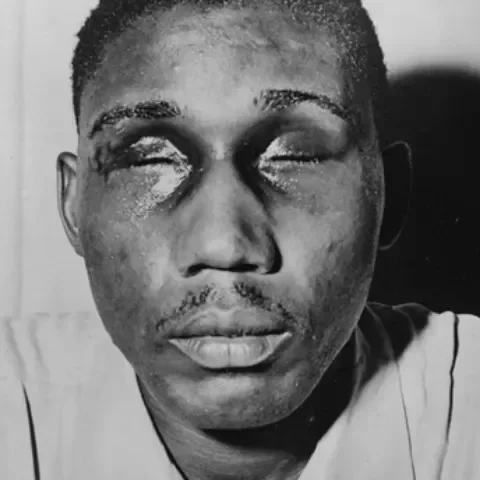2.14.1: “The Blinding of Isaac Woodard”