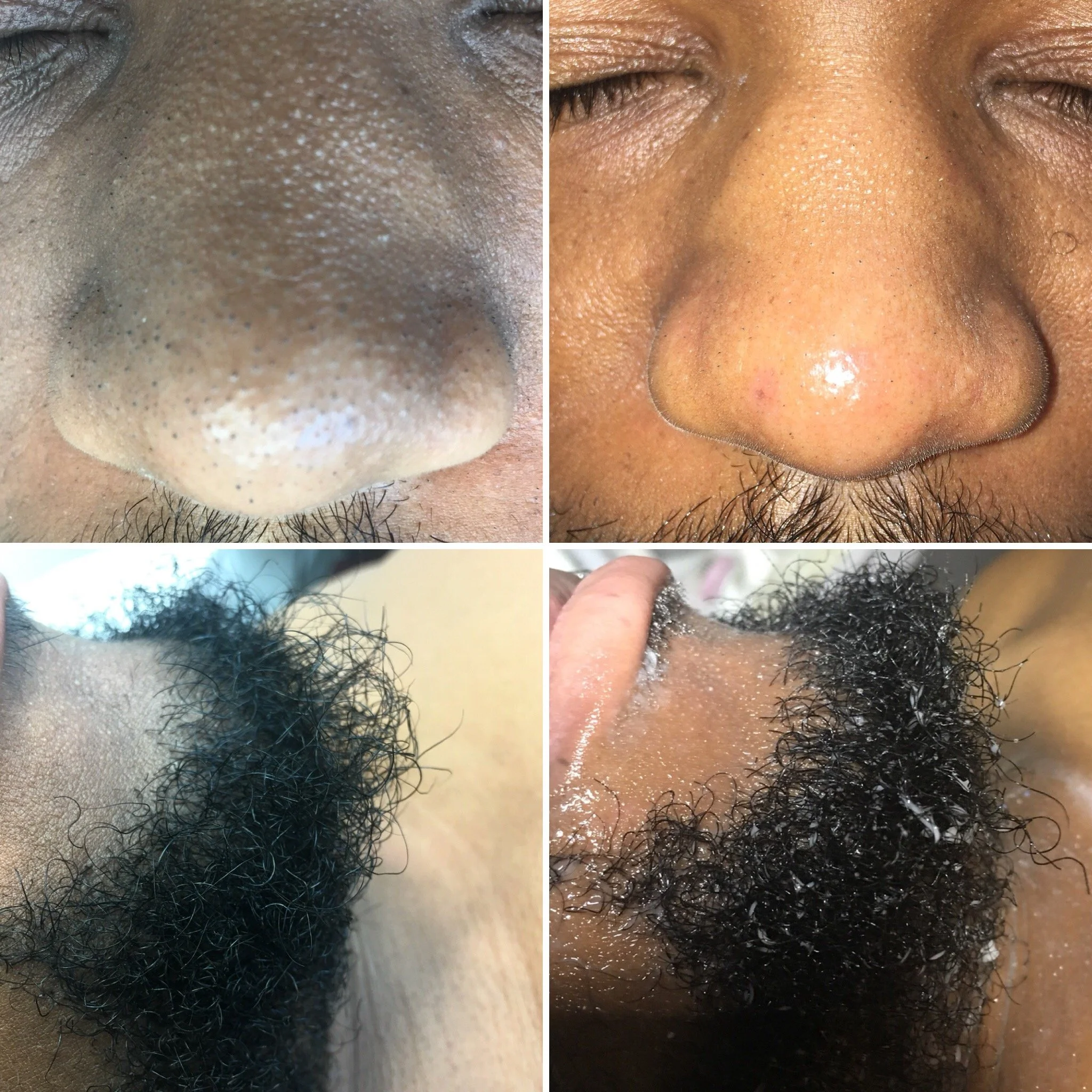 Close-up images of a man's nose, showing the difference before and after cleaning, and pictures of his facial hair with soap lather, highlighting the removal of dirt and oil.