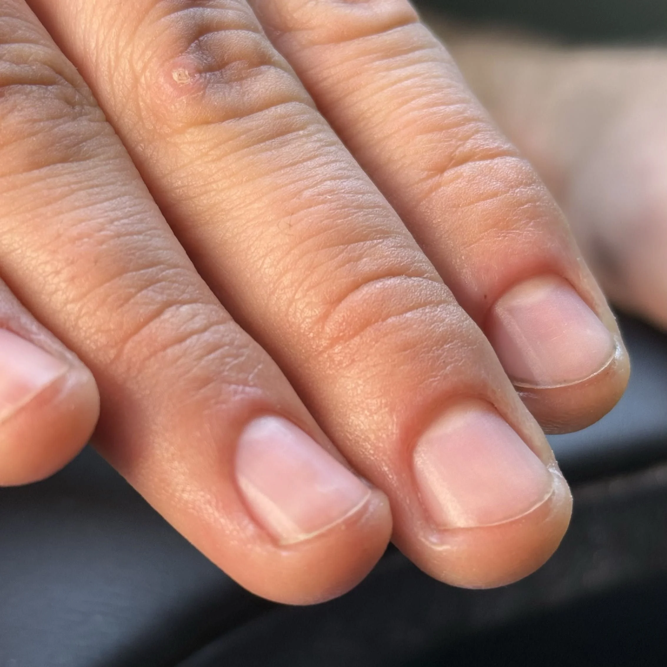 Close-up of a person's fingers resting on a dark surface, showing skin texture and clean nails.