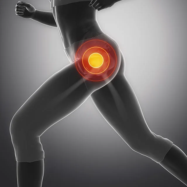 Hip Pain While Running: Why It Happens and How to Get Back on the Road