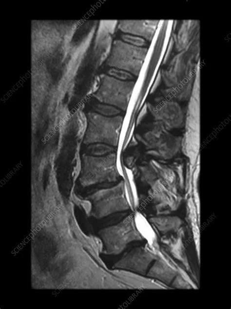 Do You Really Need an MRI for Pain?