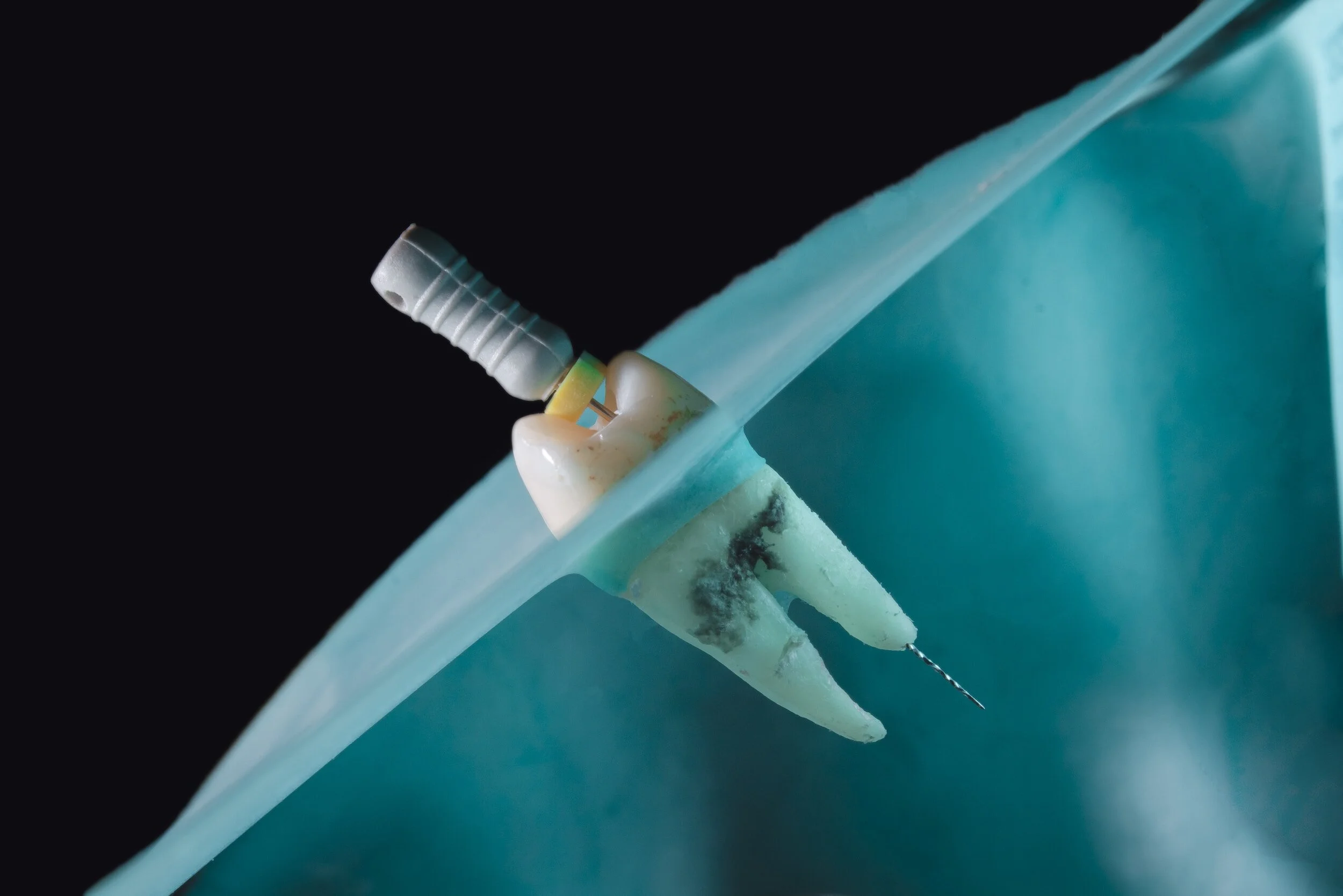 Endodonzia