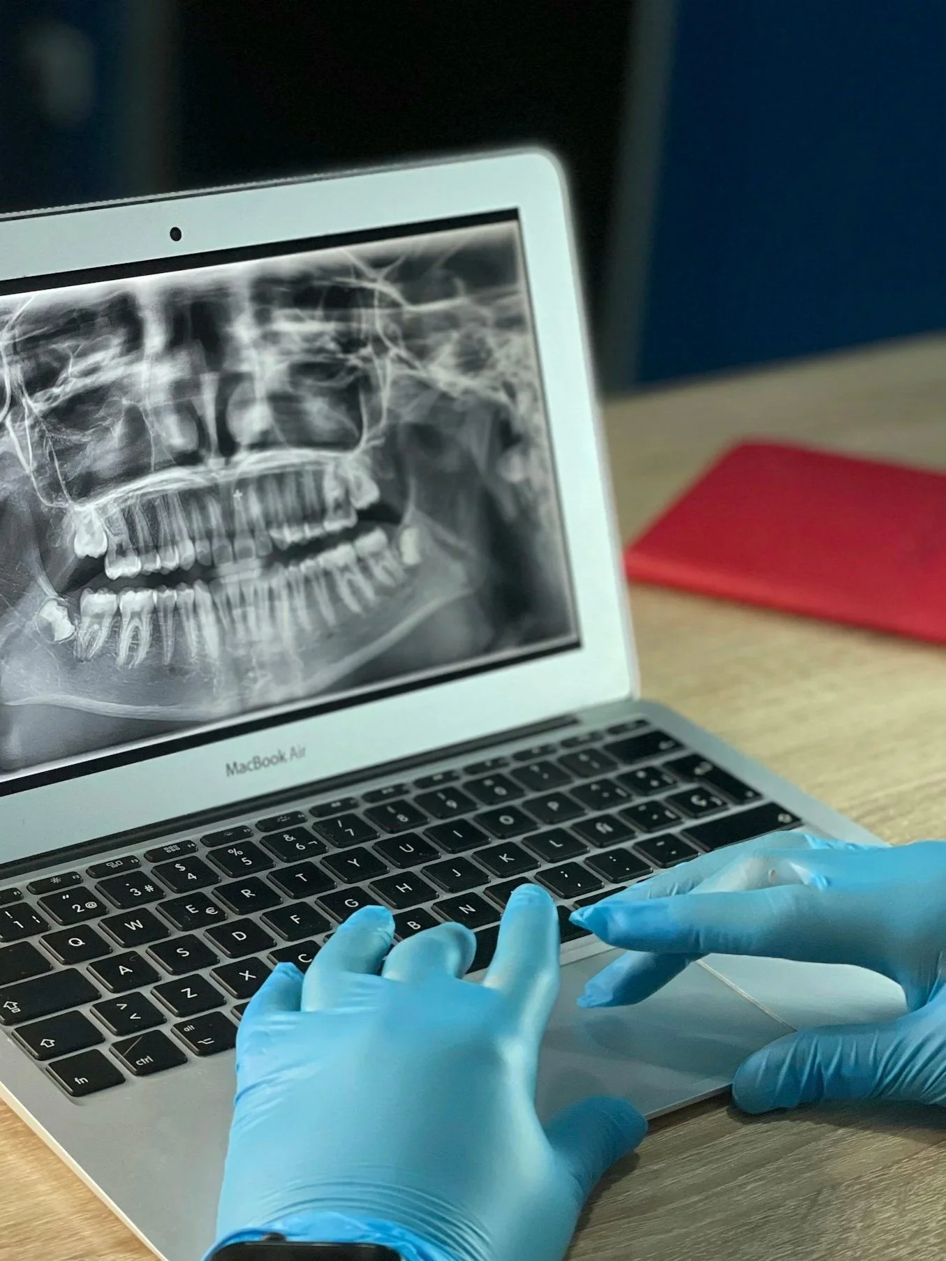 Un computer portatile MacBook Air mostra un'immagine di una radiografia dentale sullo schermo. Sul tavolo ci sono mani con guanti in lattice blu, probabilmente di un medico o di un dentista, che digitano sulla tastiera.