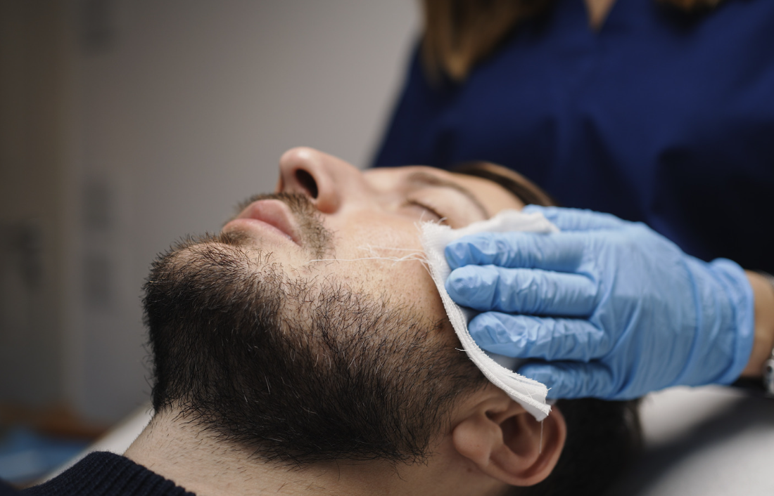 Un medico con guanti blu sta pulendo il viso di un uomo con una barba che è sdraiato.