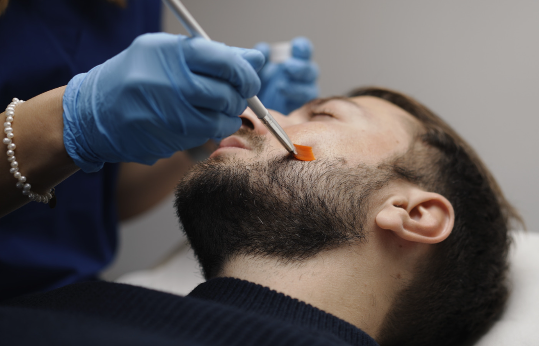 Un medico in guanti blu fa un intervento di microblading sulle sopracciglia di un uomo disteso.