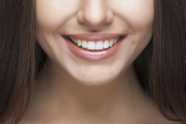 Primo piano di una donna sorridente con denti bianchi e sorriso aperto.