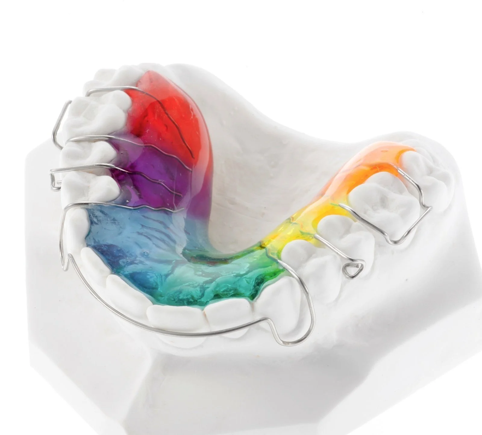 Modello di arcata dentale con fili ortodontici e colorazioni arcobaleno che rappresentano un arco di colori.