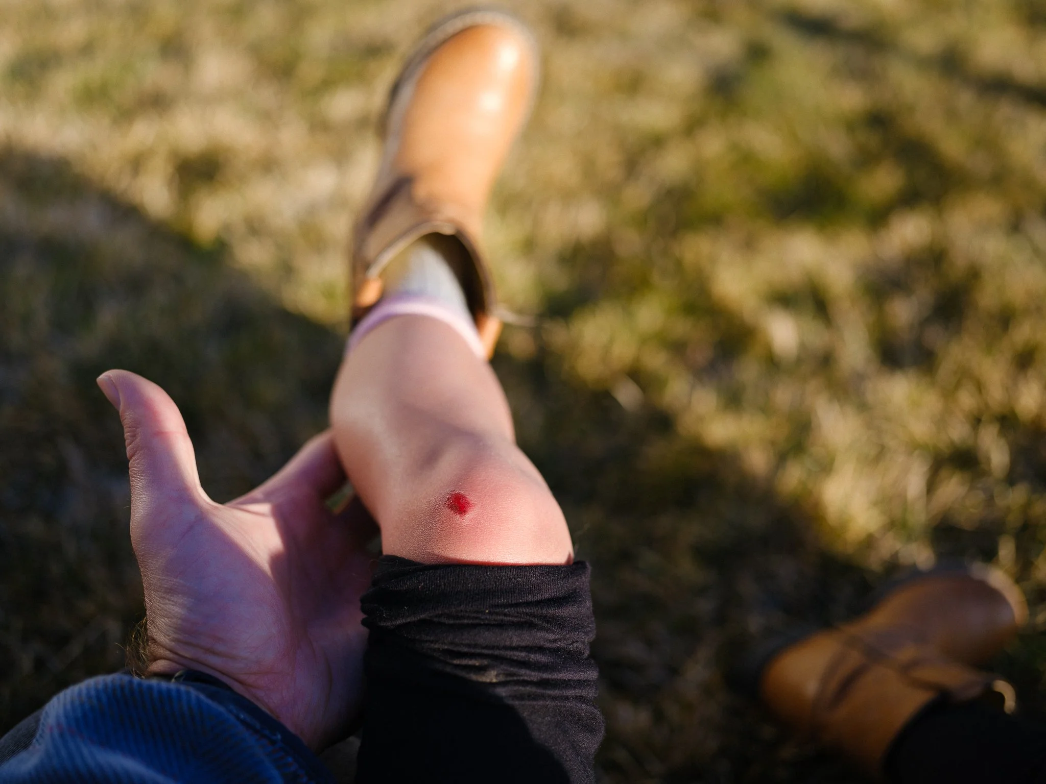 I need a bandaid