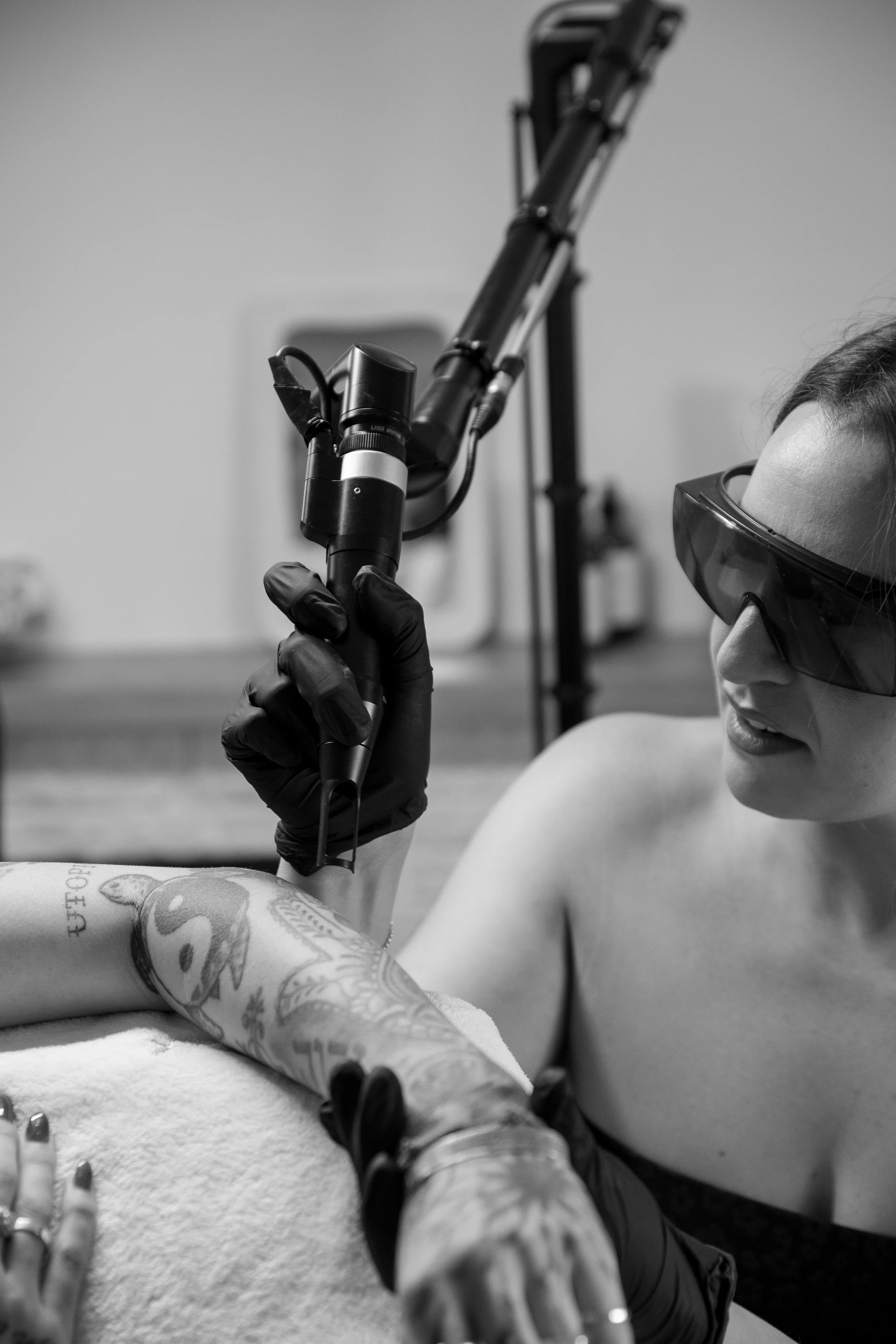 Laser Tattoo Removal