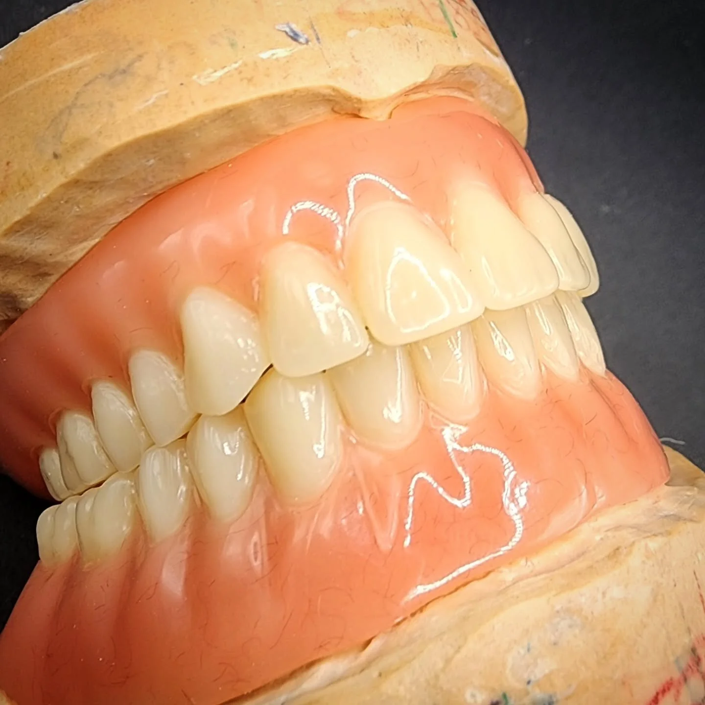 A beautiful set of upper &amp; lower acrylic dentures, for a client in County Wicklow. 🦷✨ #dentures #smile #client #Wicklow