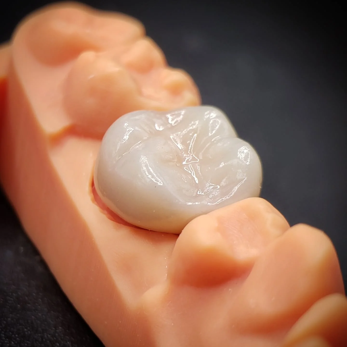 This beautiful PFZ crown shows the realistic translucency that makes them such a favourite.