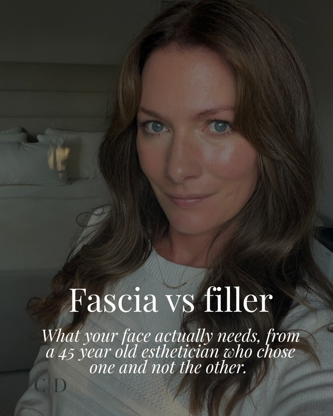 Fascia vs filler. This is not an attack on filler, but most women deserve to know what&rsquo;s happening underneath their face before they decide. 

In many cases, the face doesn&rsquo;t need more volume. It needs what&rsquo;s underneath the volume t