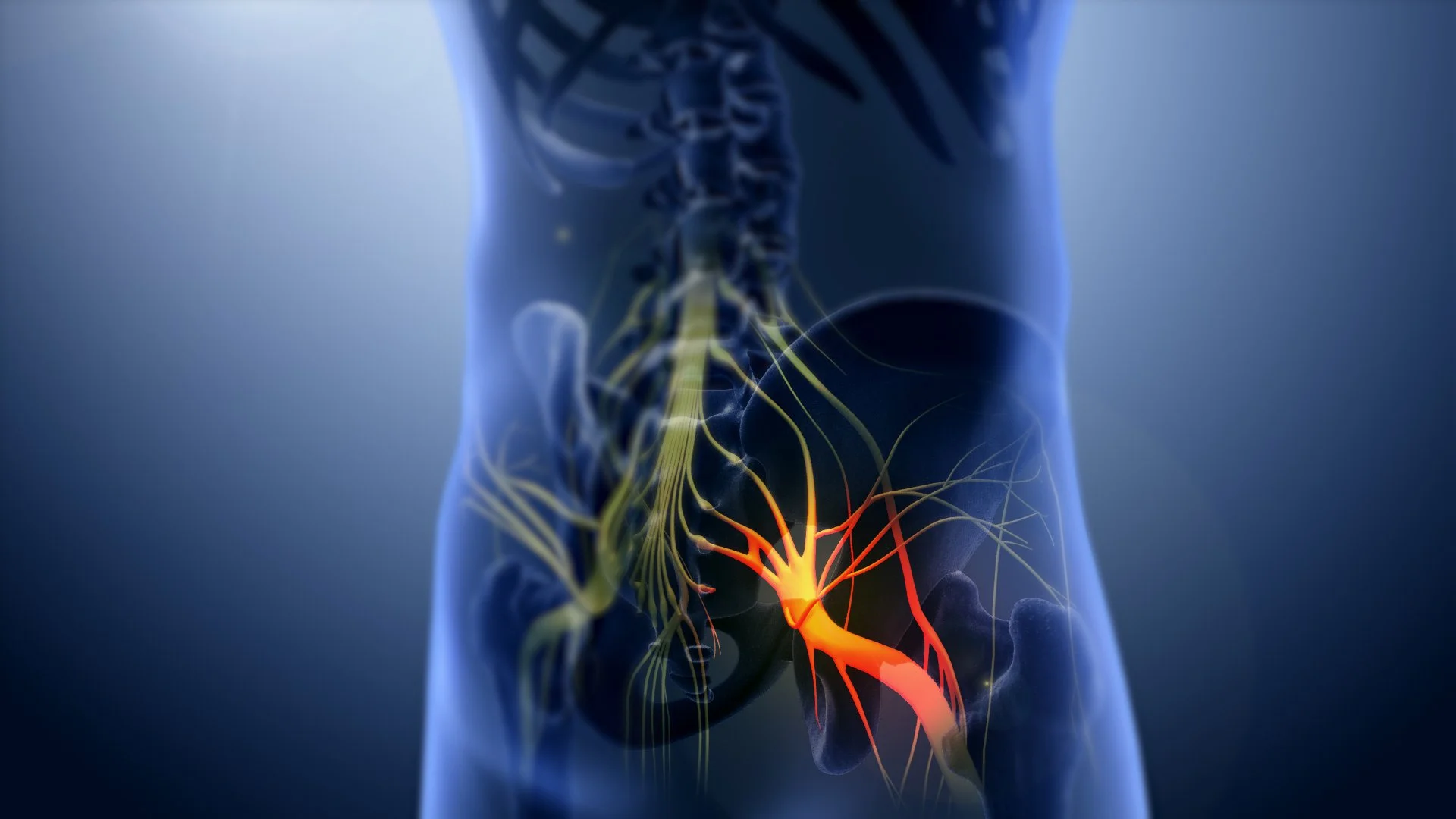 Can Massage Help with Sciatica?