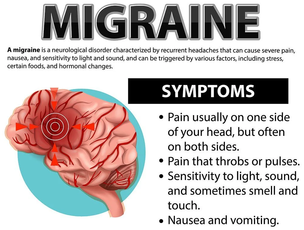 Migraines Are Awful. Here’s What Actually Helps—Fast.