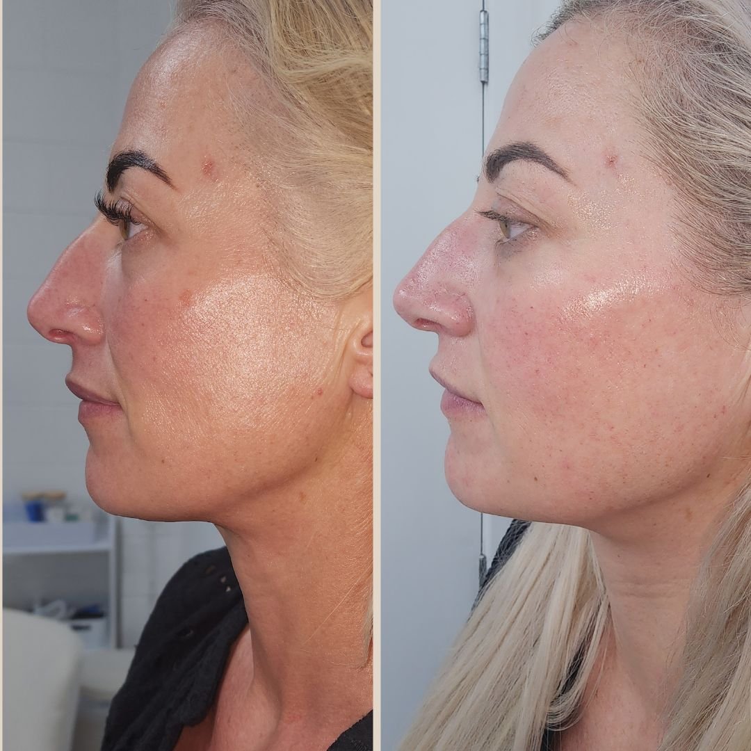 Hydration, texture & skin vitality treatment