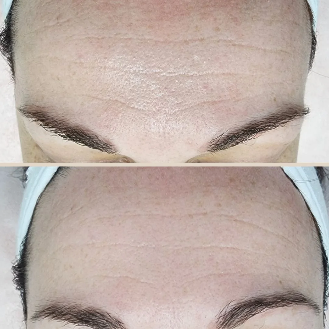 Fine lines, hydration & skin smoothing