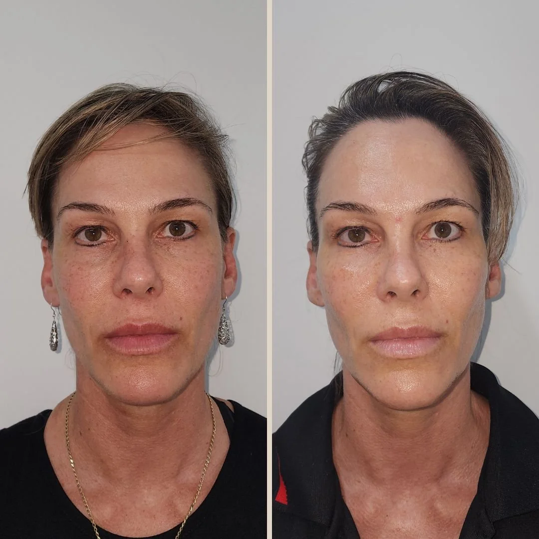 Healthy aging & skin rejuvenation treatment