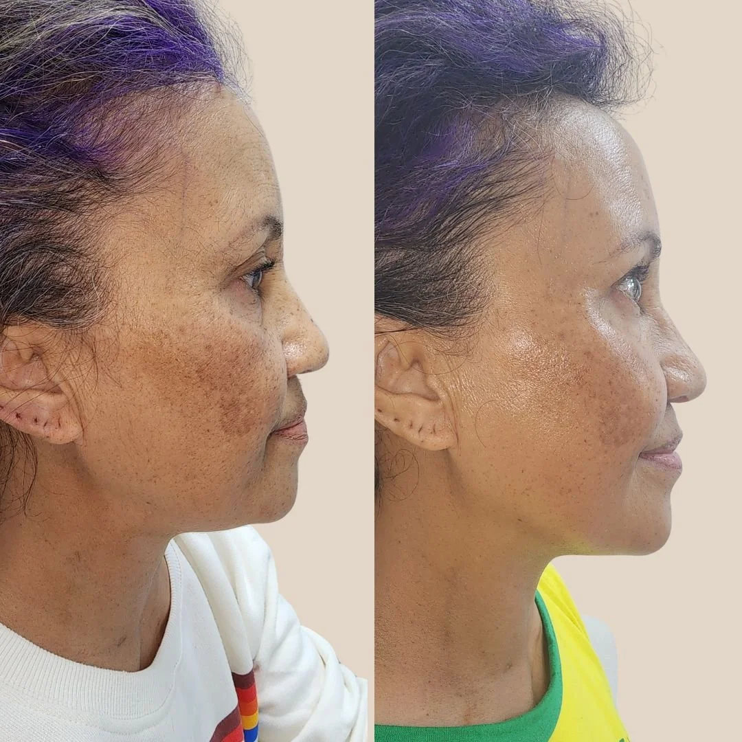 Skin vitality & radiance restoration