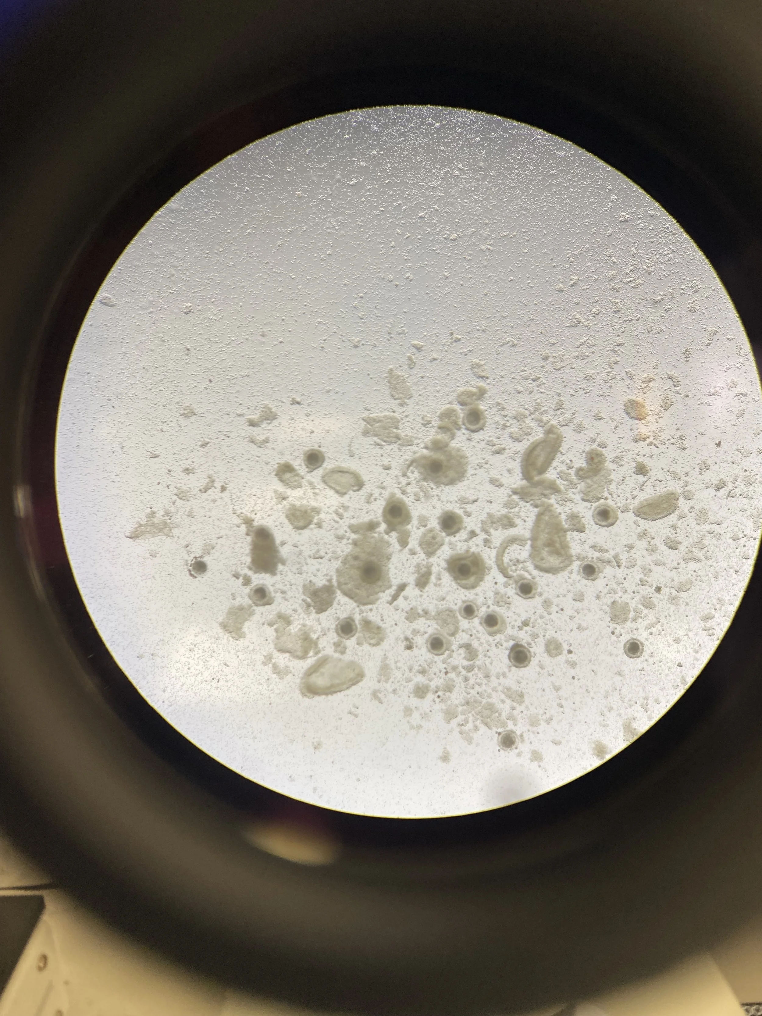 Porcine cumulus-oocyte complex (COC) under microscope