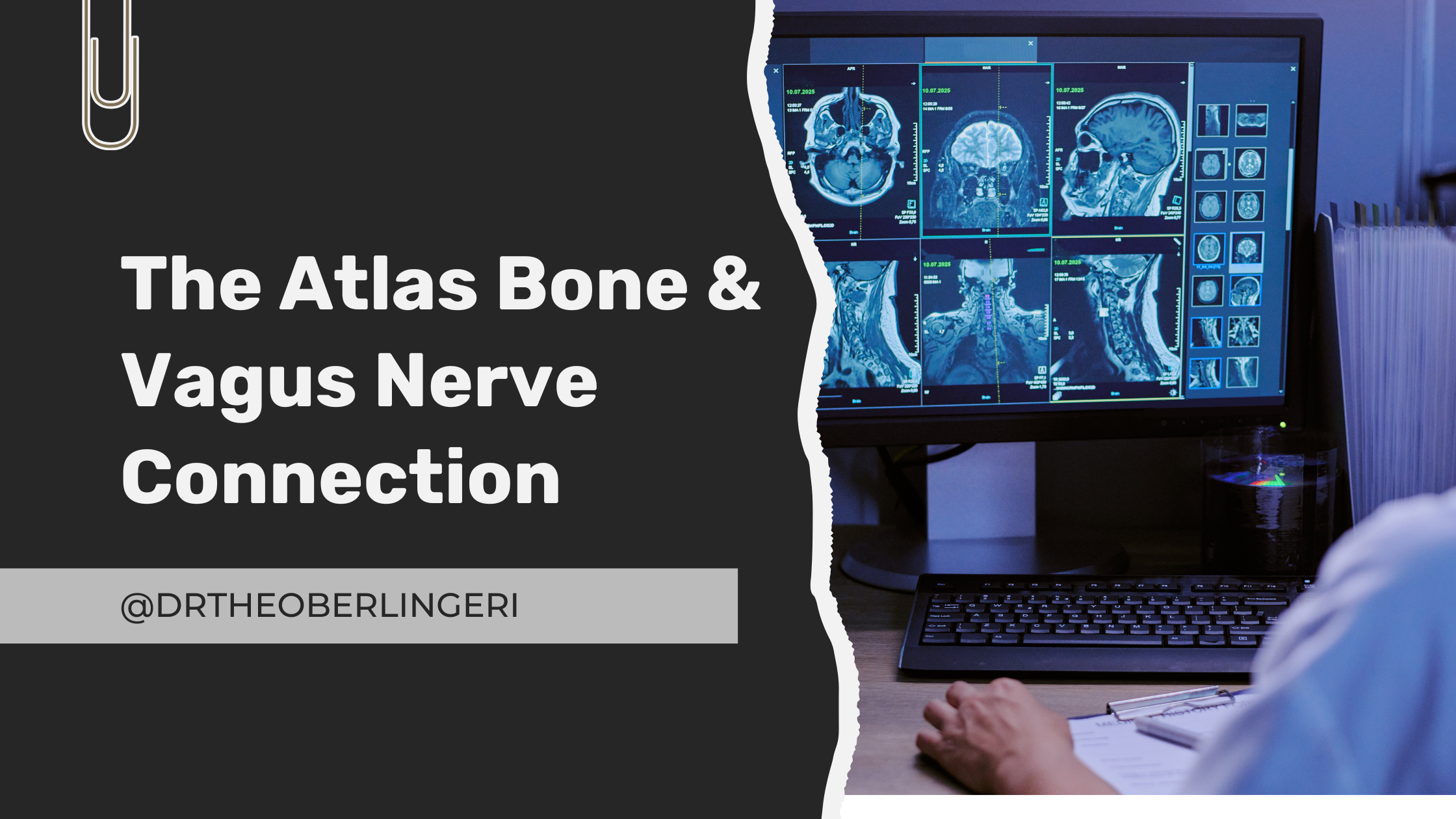 The Atlas Bone &amp; Vagus Nerve Connection