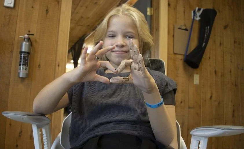 young girl with prosthetic design making an heart emote with her new hand and her organic one, showcasing true mastery of concept art applied into concept design and final execution. Miguel provided artist expertise as freelancer to this company.