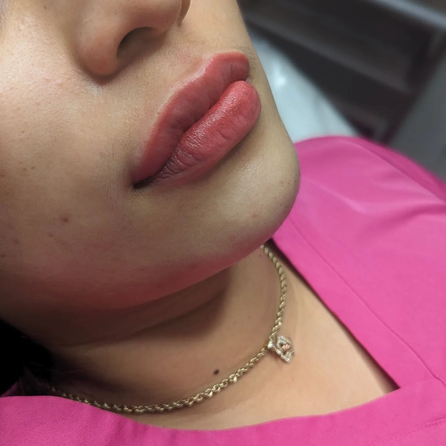A Beautiful Neutralization I did the other day! Swipe Left to see that before pictures!  This Color, Malina Ice and Sweet Melissa was the perfect color to cover up the spots of hyperpigmentation in her lips while also complementing her skin tone perf
