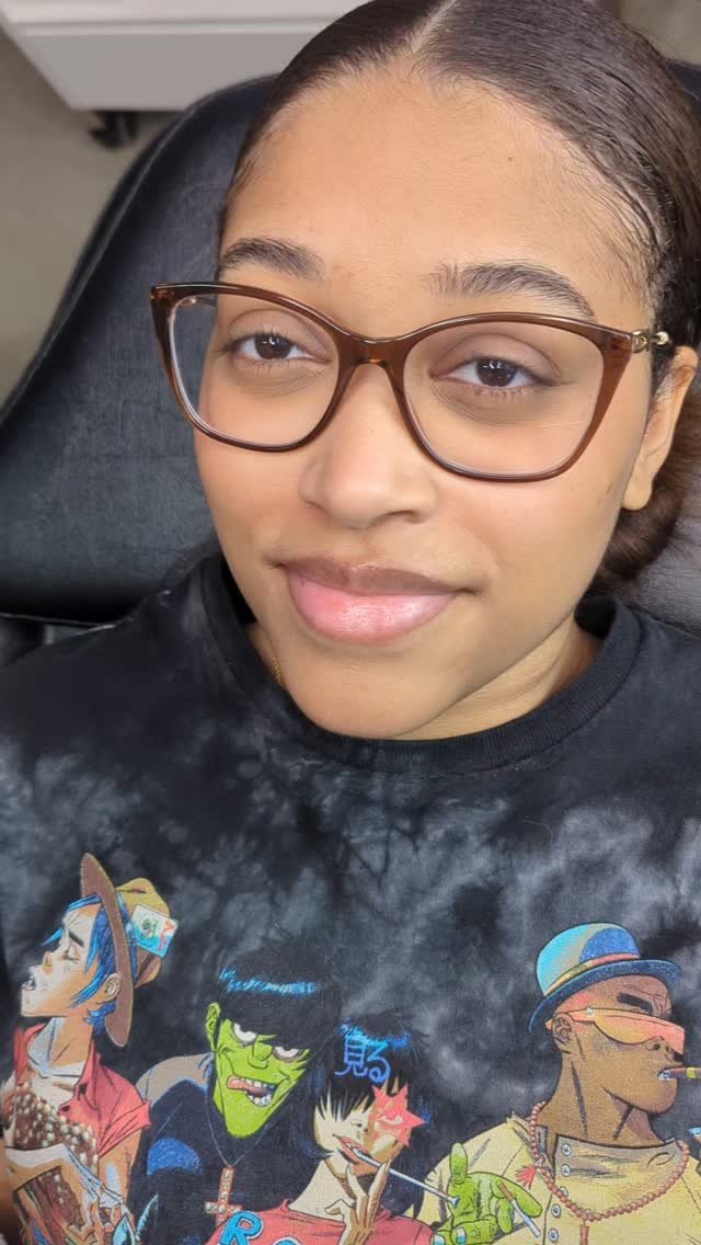 Looking for a solution to the hyperpigmentation in your lips? Hyperpigmentation can be caused by multiple factors including genetics, smoking, sun exposure and trauma to the skin such as biting your lips. Many people don't realize that there are solu