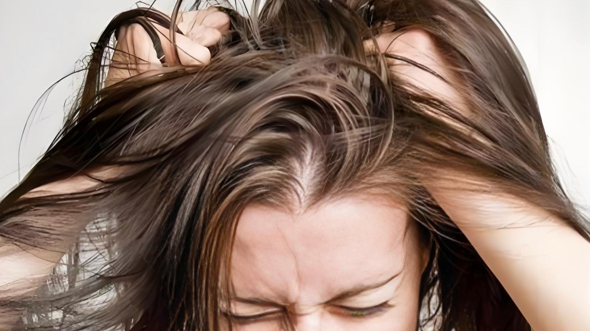 Itchy Scalp Relief: What’s Really Causing the Itch—and How to Finally Fix It？