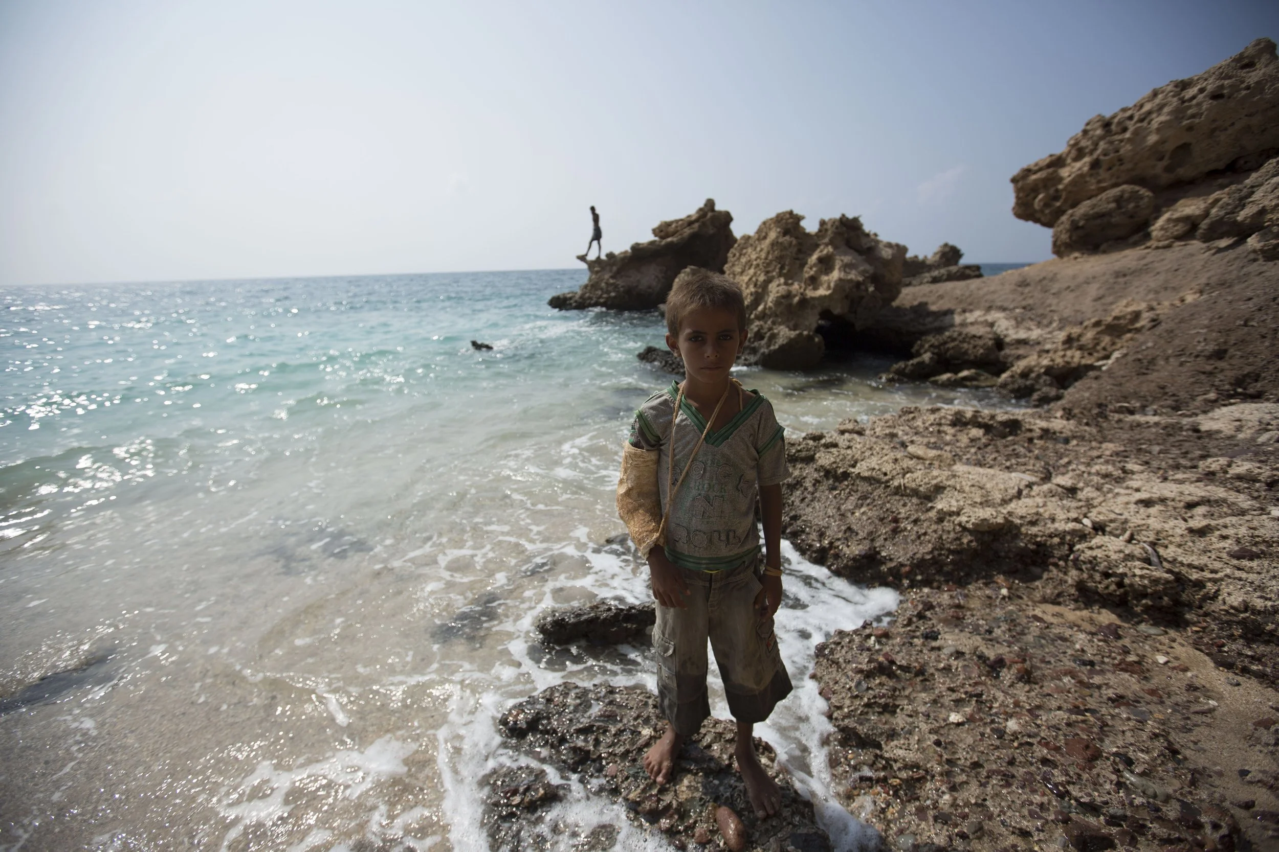 Yemeni refugee Mediene Abulrahman Albaguess, 6, came down despite his injured arm to watch his older brothers take a dive.