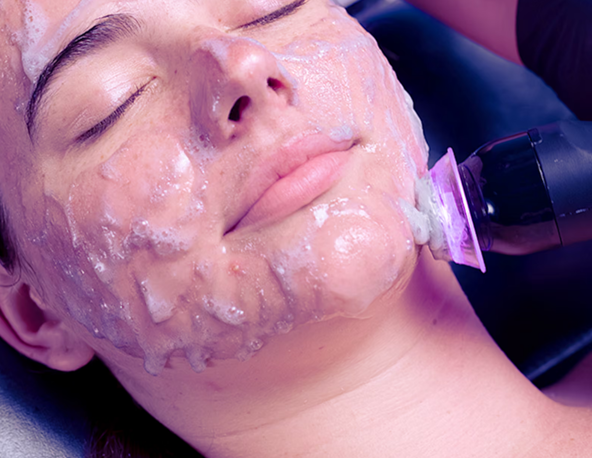 Meet Clarify: The New Glo2Facial for Acne-Prone Skin, Now at Papillon in Mount Prospect
