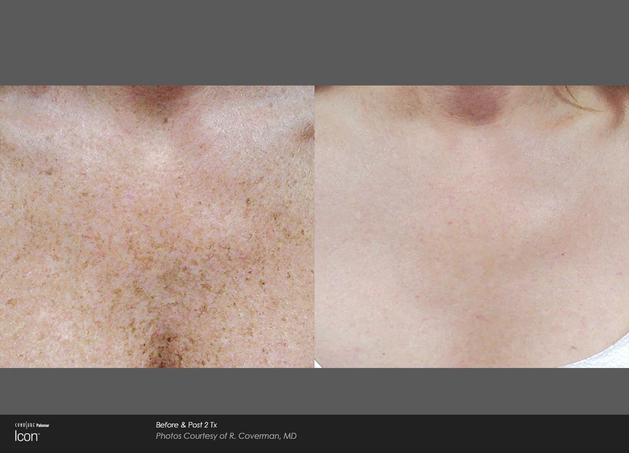 Skin-Revitalization-Before-After-Photo-7.jpg