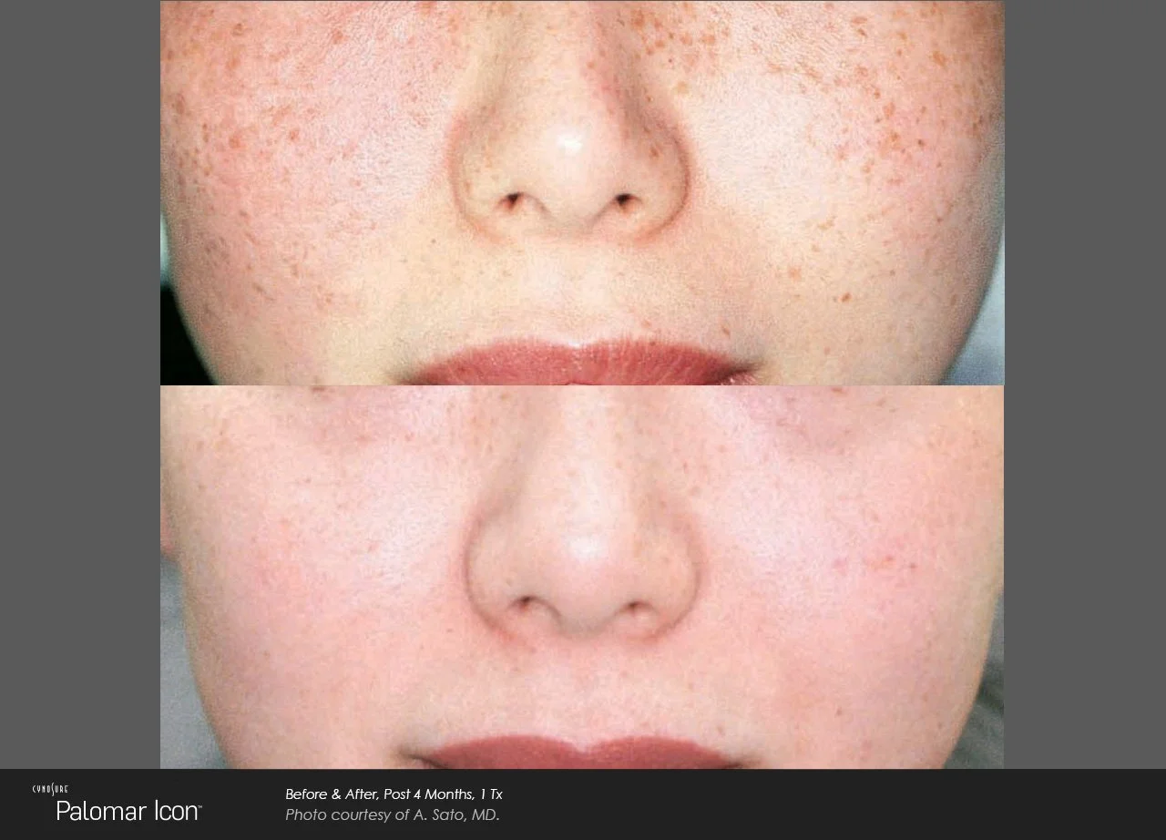 Skin-Revitalization-Before-After-Photo-2.jpg