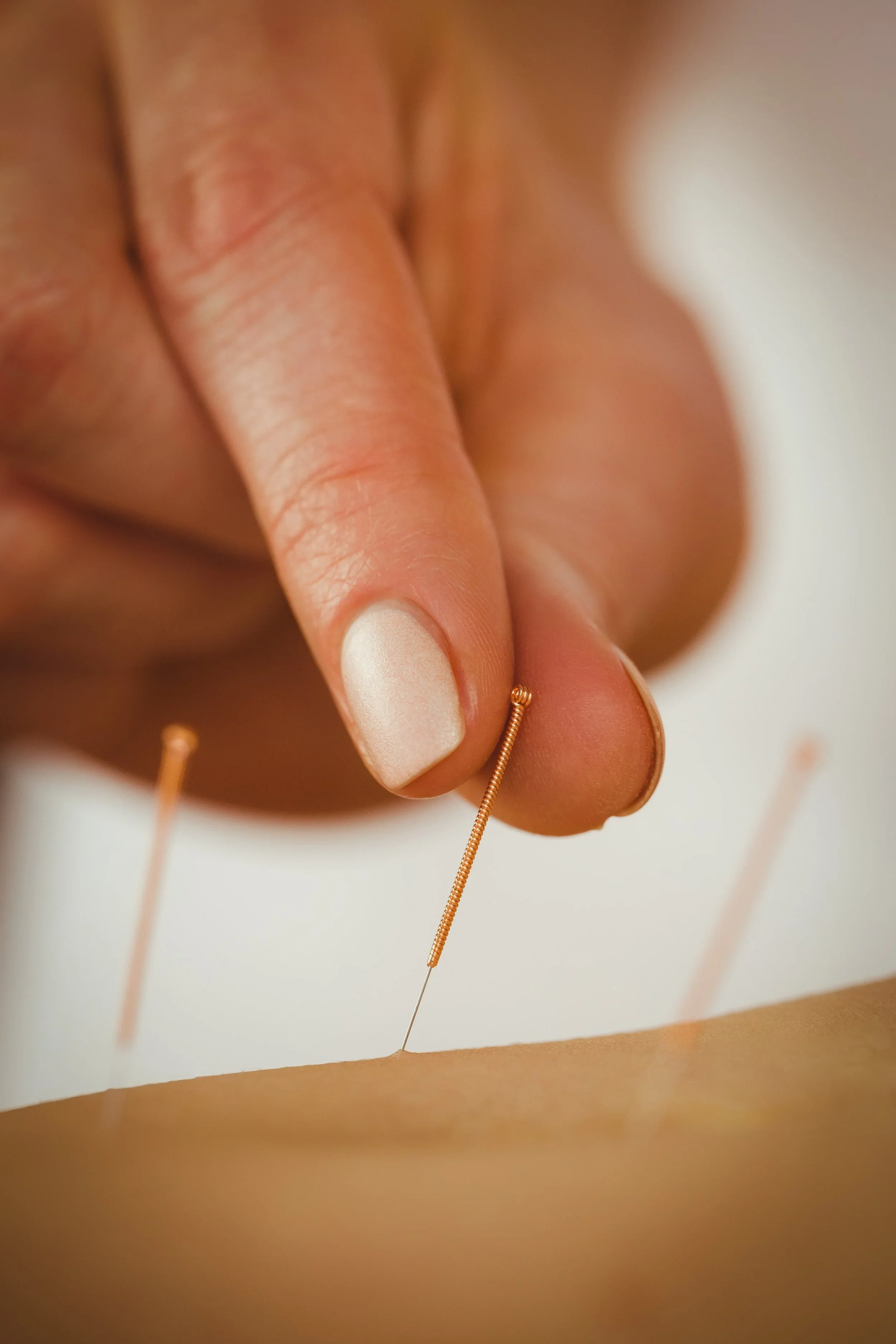 Close-up of a gentle acupuncture needle insertion for pain relief and energy balance.