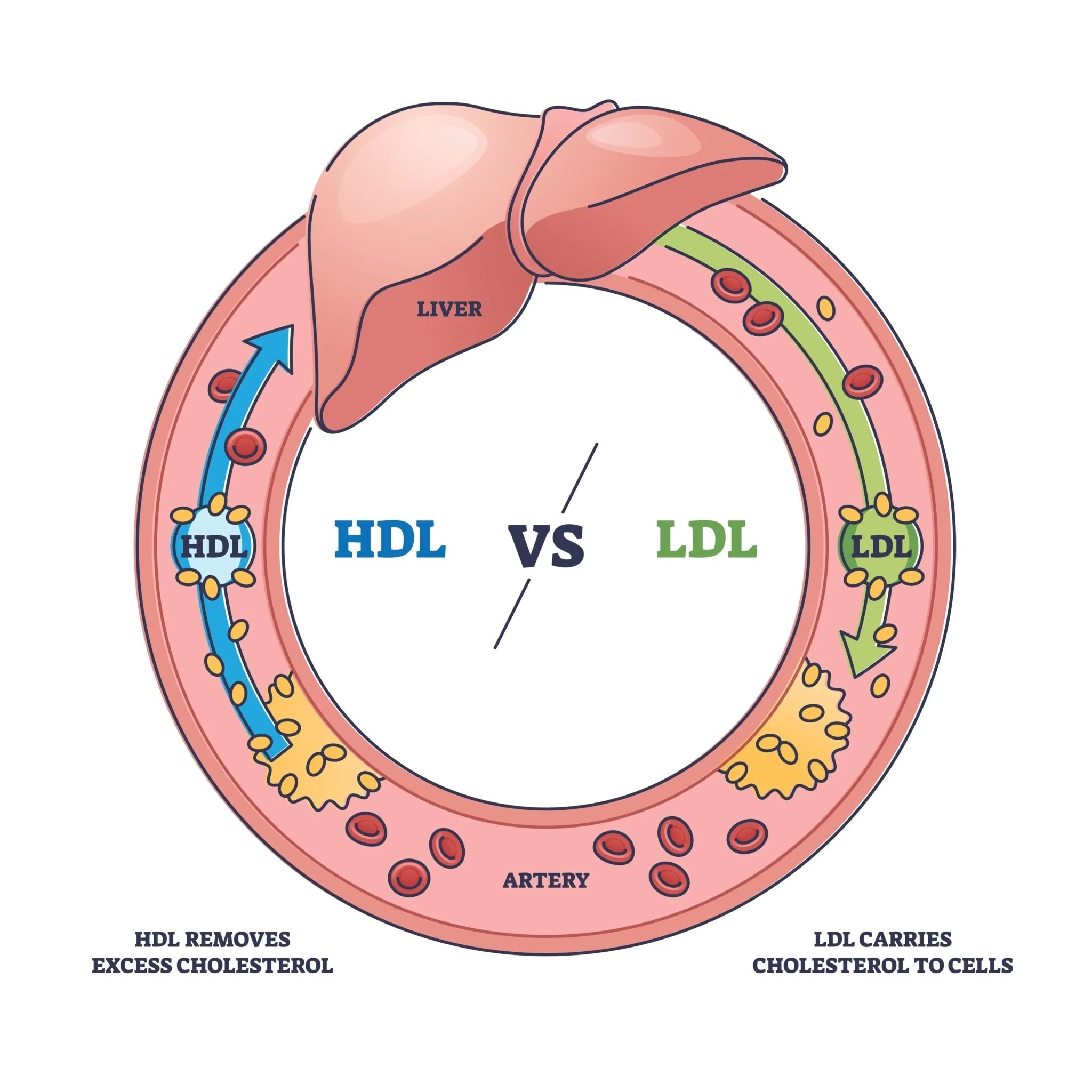 Rethinking Heart Health: Is Cholesterol the Whole Story?