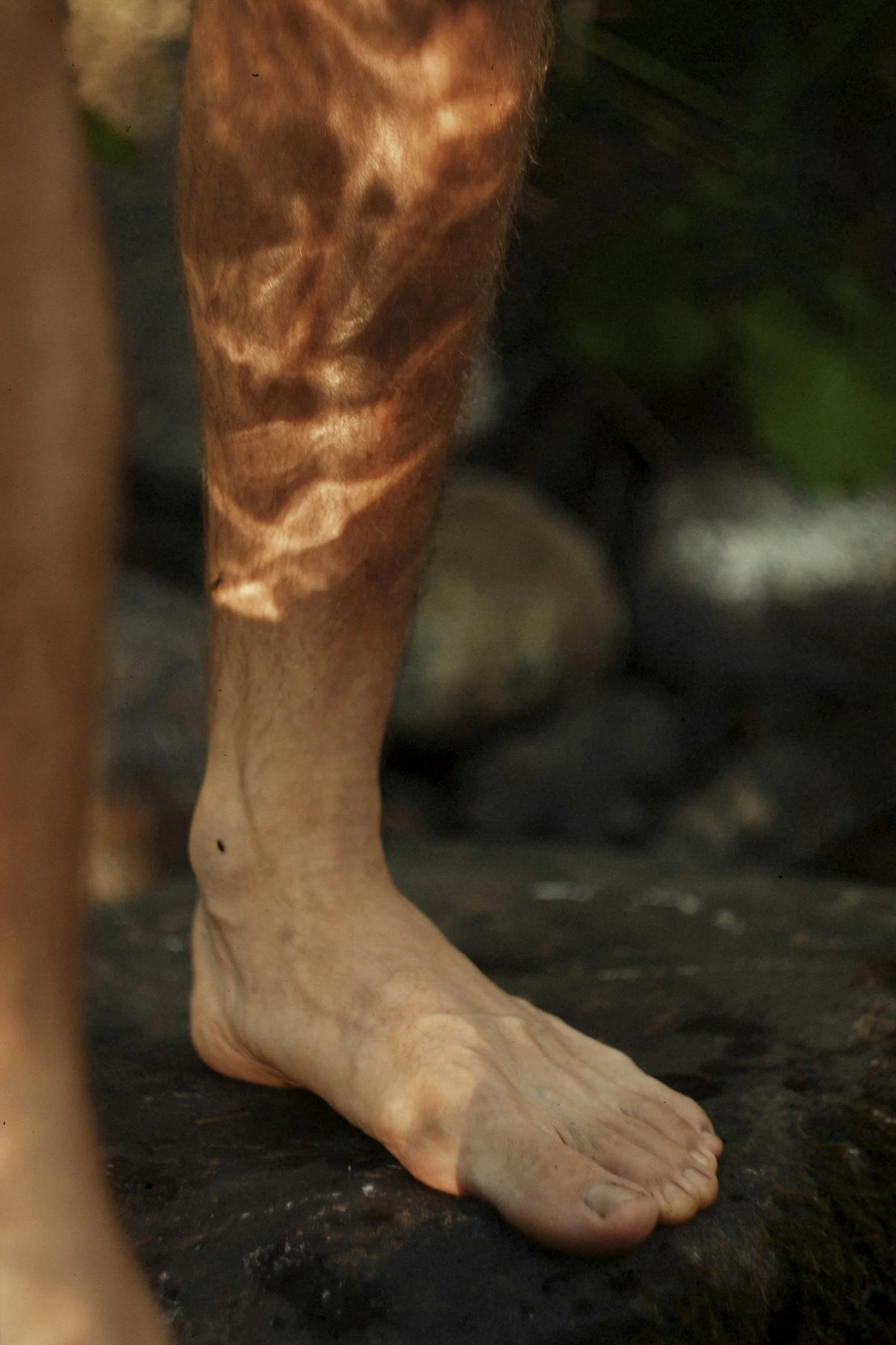 Pain Down the Leg That Isn’t Sciatica