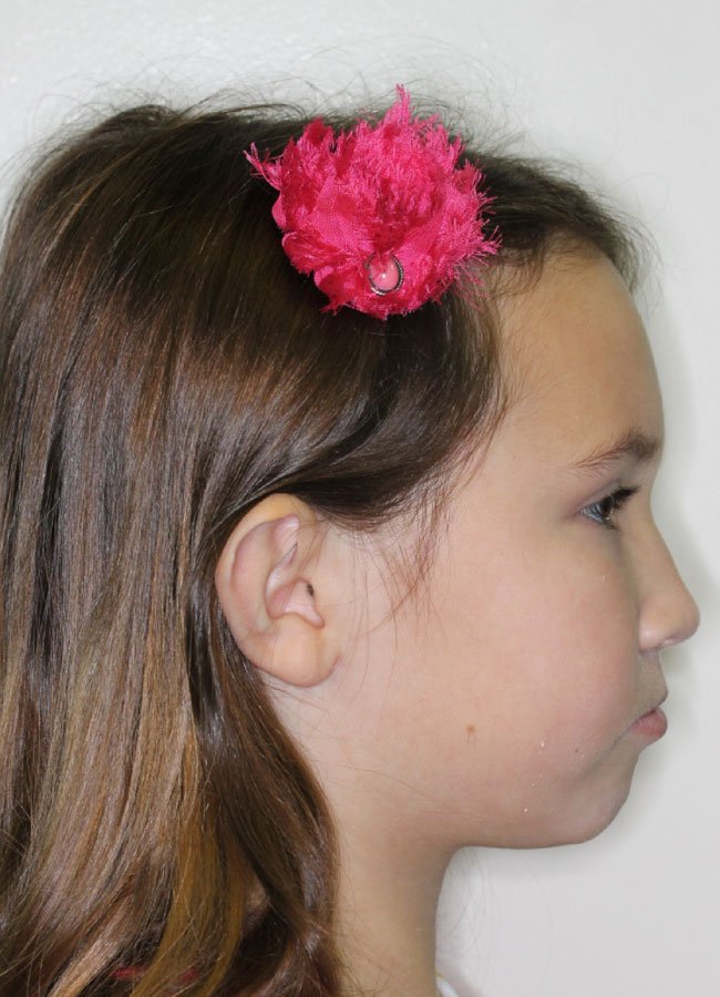 beecroft-patient-Molly-S-after.jpg