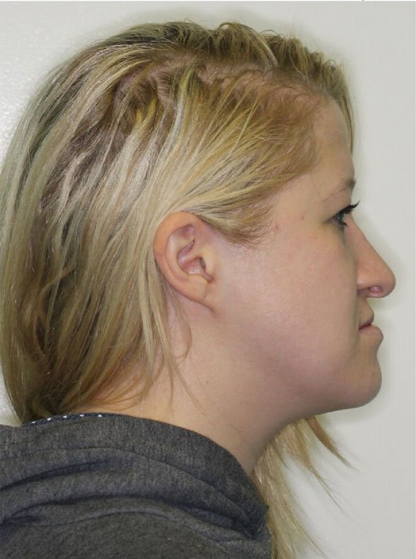 Elena-S-before-profile.jpg