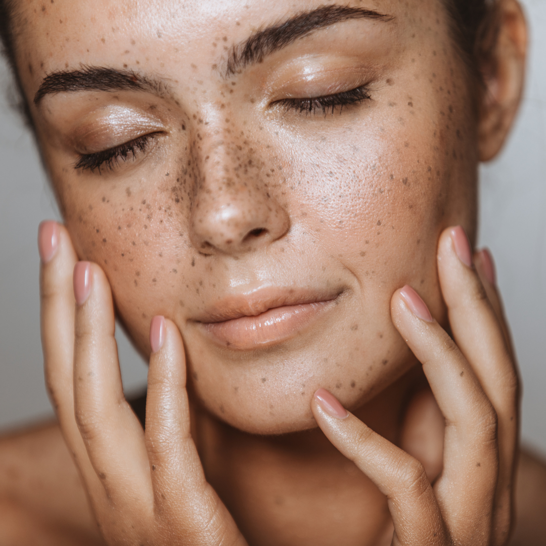 Microneedling Amsterdam