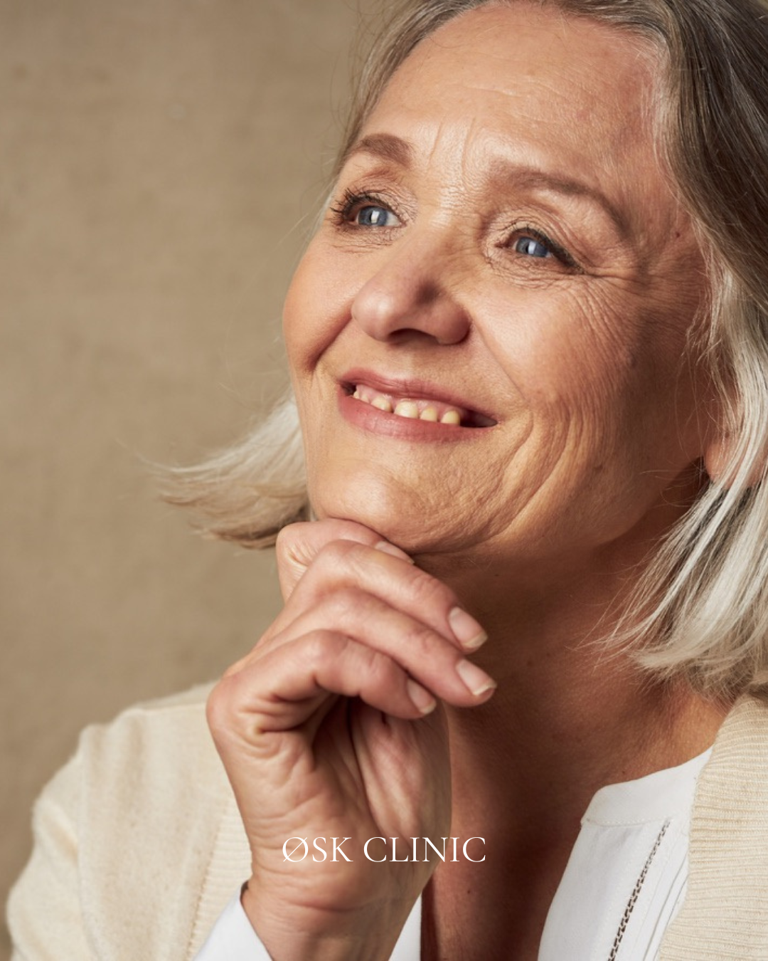 Skinbooster behandeling Amsterdam, Viscoderm hydrobooster, huidverbetering, huidkwaliteit, cosmetisch kliniek Amsterdam
