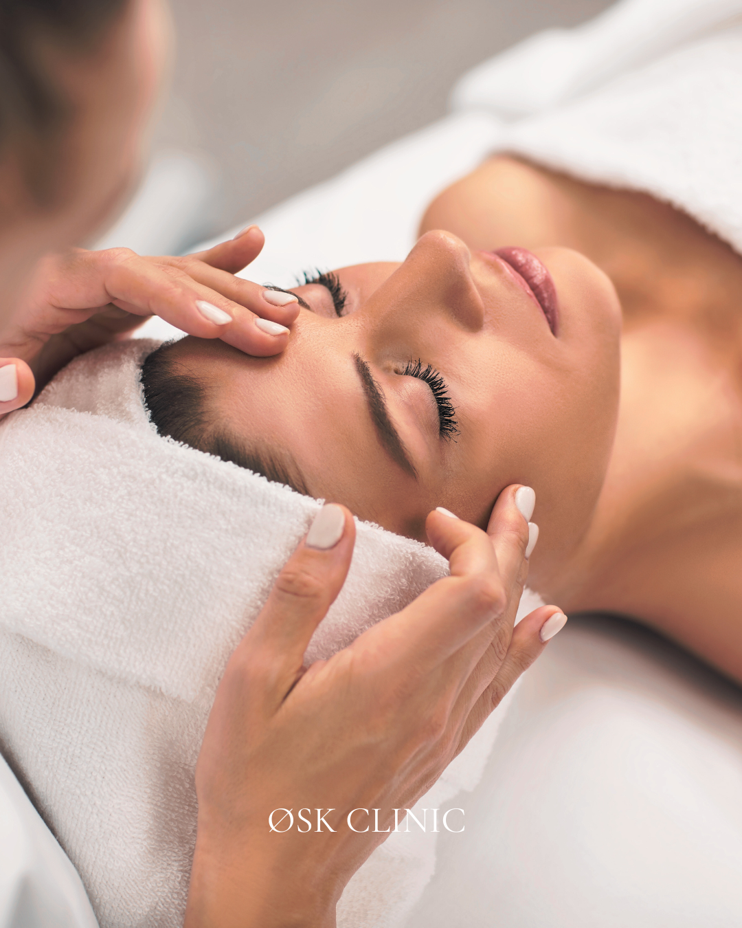 Microneedling voor huidverbetering