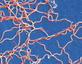 Spirochete.JPG