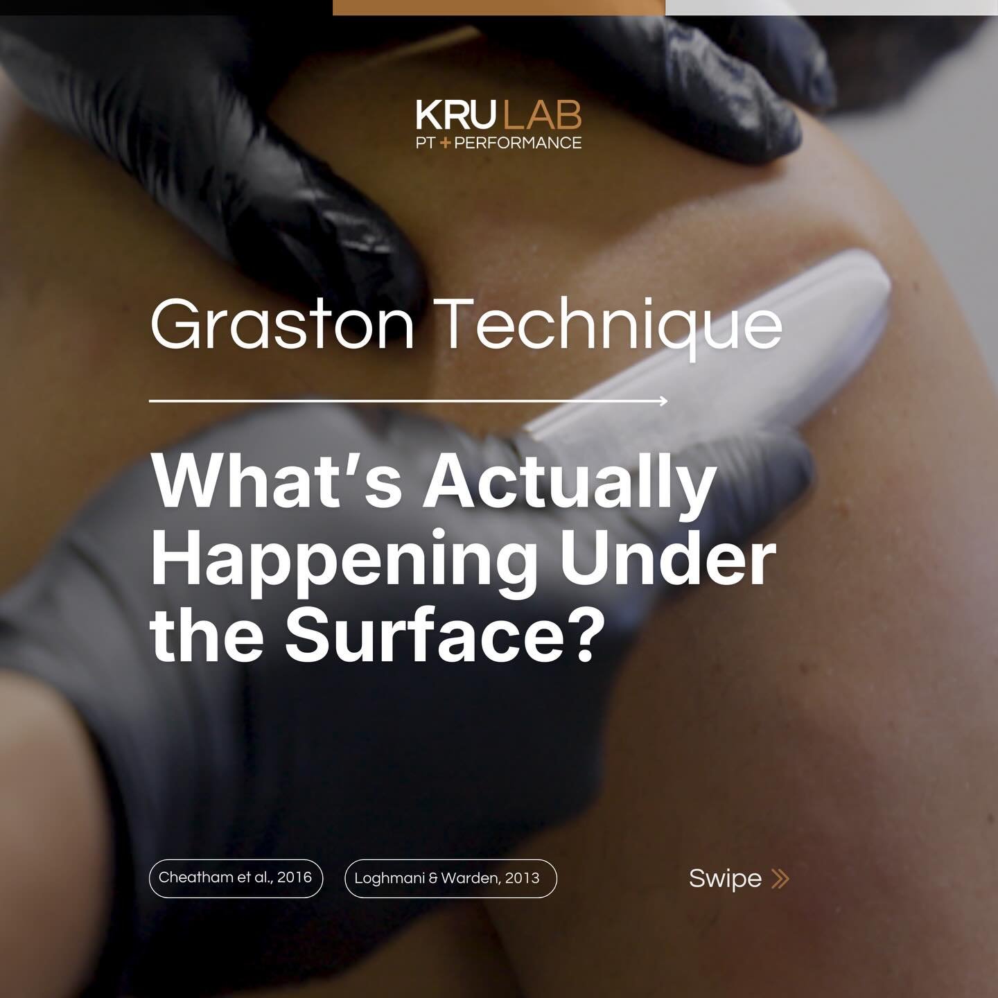 Graston Technique is a tool physical therapists use to improve how muscles, tendons, and fascia move.
Using specialized instruments, clinicians apply controlled mechanical stimulation to soft tissue. Research suggests this may increase circulation, s