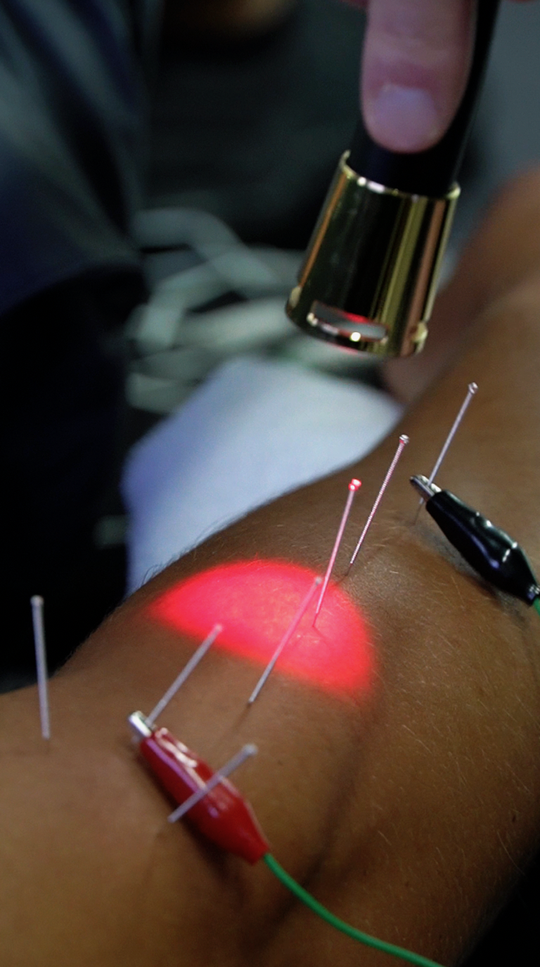 Tennis Elbow Isn’t Just About the Elbow